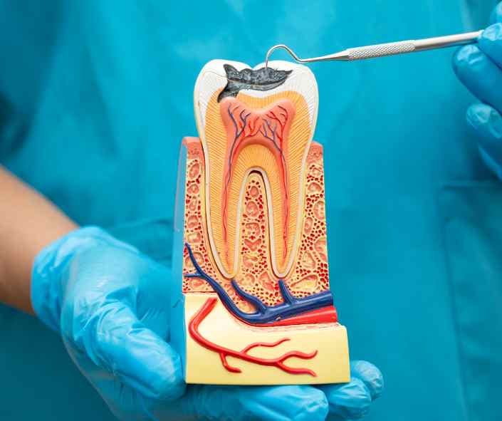 Access the pulp chamber from the top of the tooth